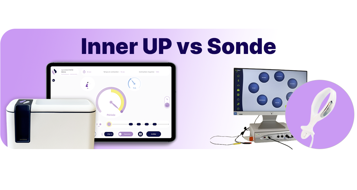 banner IUP vs sonde